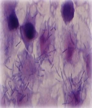 Lactobacillus johnsonii. Lactobacillus spp. aislado del intestino del pollo presenta efectos inhibitorios sobre el crecimiento de las bacterias pat&oacute;genas. (Foto cortes&iacute;a de: Institute of Food Research, UK. )