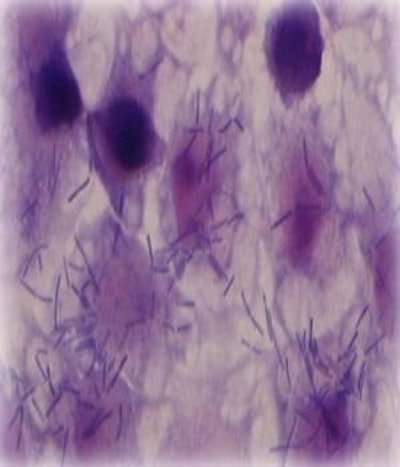 Lactobacillus johnsonii. Lactobacillus spp. aislado del intestino del pollo presenta efectos inhibitorios sobre el crecimiento de las bacterias patógenas. (Foto cortesía de: Institute of Food Research, UK. )