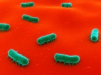 SebastianKaulitzki I Dreamstime.com | Salmonella Heidelberg is a human pathogen, which is receiving increased regulatory attention after a significant outbreak was associated with ground turkey in 2011.
