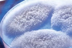 Fumonisins are harmful fungal metabolites mainly produced by Fusarium proliferatrum (shown above), and F verticilloides.