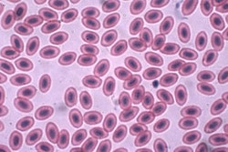 Chicken red blood cells magnified 1000 times | John Alan Elson | Wikimedia Commons