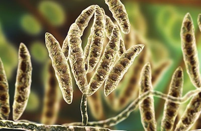 Fusarium (Kateryna Kon | Shutterstock.com)