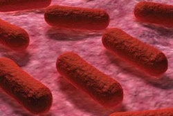 Antibiotic-resistant-ecoli-1502FIAnimalHealth1