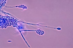 Fusarium_mycotoxin_Wikimedia-Commons