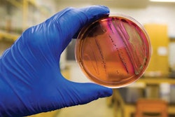 antibiotic-resistant-escherichia-coli-1510-4