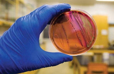 antibiotic-resistant-escherichia-coli-1510-4
