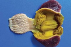 improved-gizzard-health-1412FIPoultryNutrition1