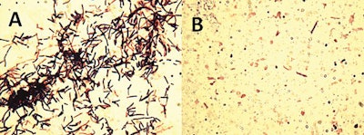 Lysis Of Clostridium Perfringens