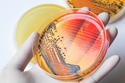 salmonella-in-animal-feed