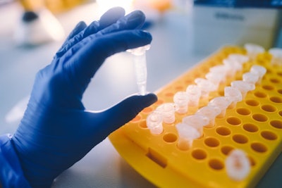 Laboratory Tests For Viral Infections. Coronavirus Ncov, Mers-co