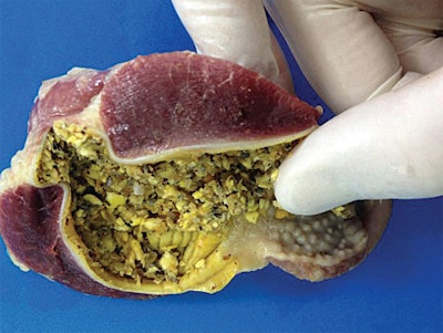 Properly sized mash feed helps to develop the muscular walls of the hen’s gizzard and supports better digestion. (Zoe Kay)