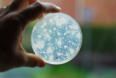 bacteria culture growing on agar plate