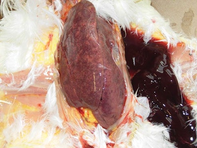 Enlarged Mottled Liver