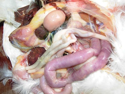 Enlarged Spleen