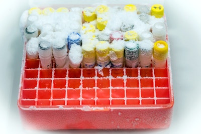 Laboratory Freezer Test Tubes Frozen